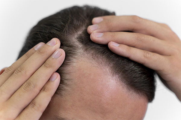 Une chevelure d'homme après un shampooing antipelliculaire